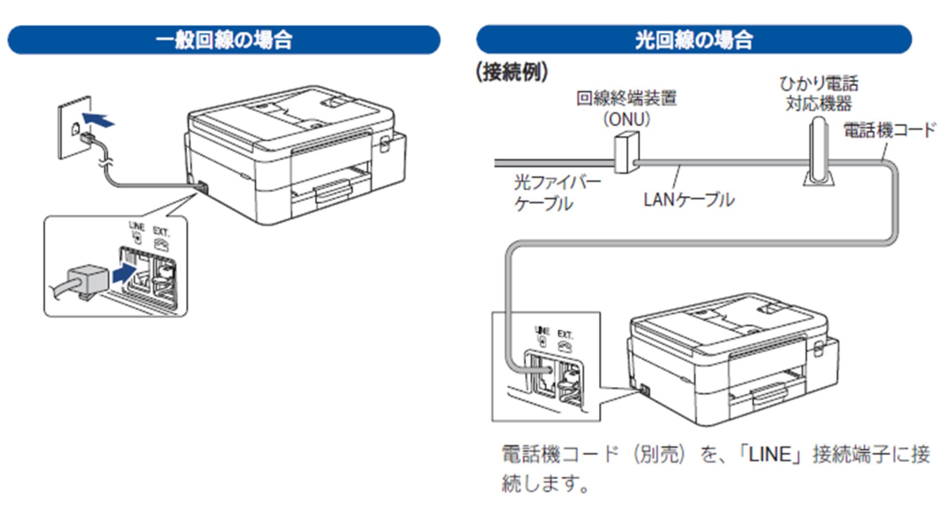 セットアップ手順｜A4インクジェット（2025年製）｜ブラザー